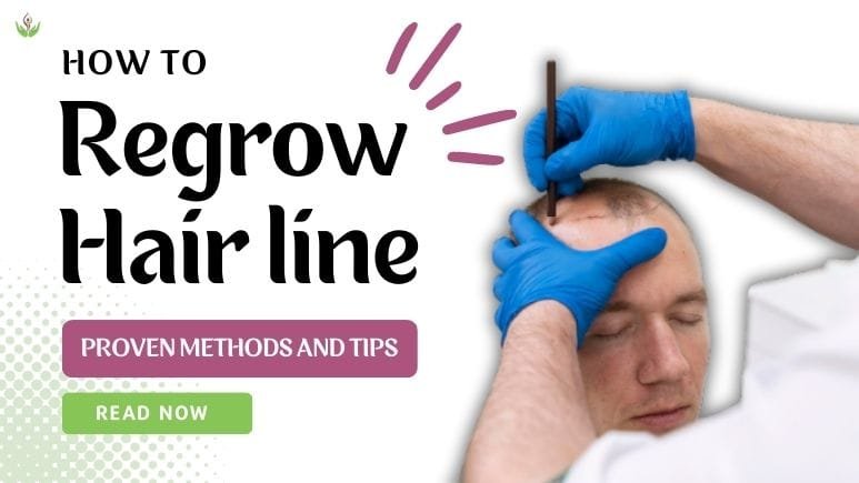 How to Regrow Hairline?