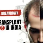 Hair Transplant Techniques Cost Breakdown in India