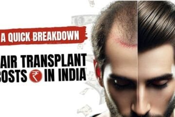 Hair Transplant Techniques Cost Breakdown in India
