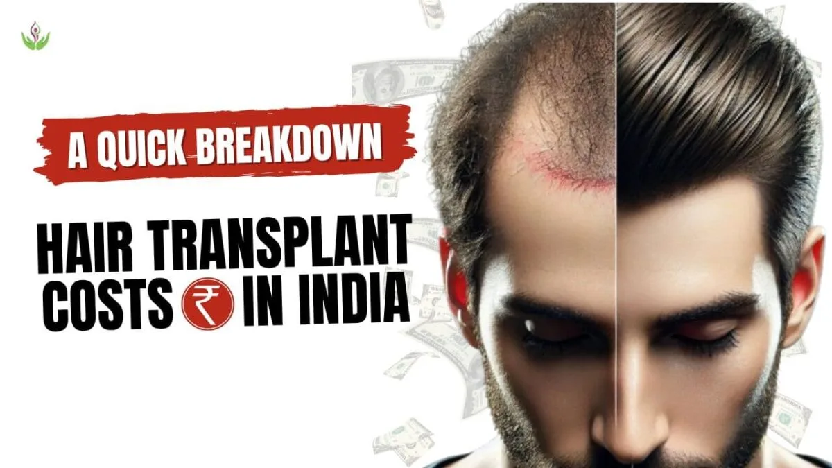Hair Transplant Techniques Cost Breakdown in India