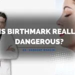 Is a birthmark really dangerous?