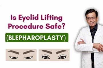 Is Eyelid Lifting (Blepharoplasty) Procedure Safe