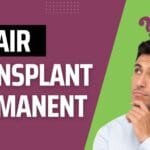Is Hair Transplant Surgery Permanent?
