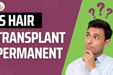 Is Hair Transplant Surgery Permanent?