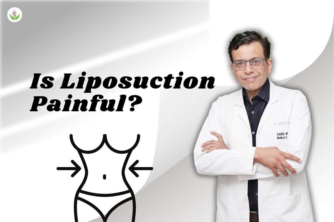 Is Liposuction Painful?