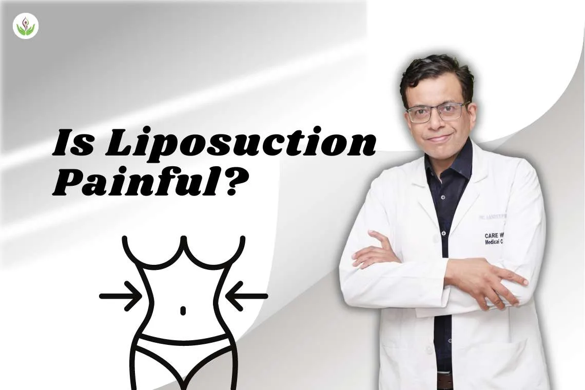 Is Liposuction Painful?