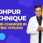 Jodhpur Technique A Best Game-Changer in Treating Vitiligo