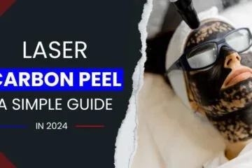 Laser Carbon Peel: A Simple Guide