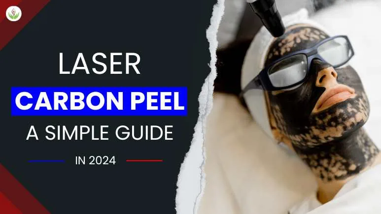 Laser Carbon Peel: A Simple Guide