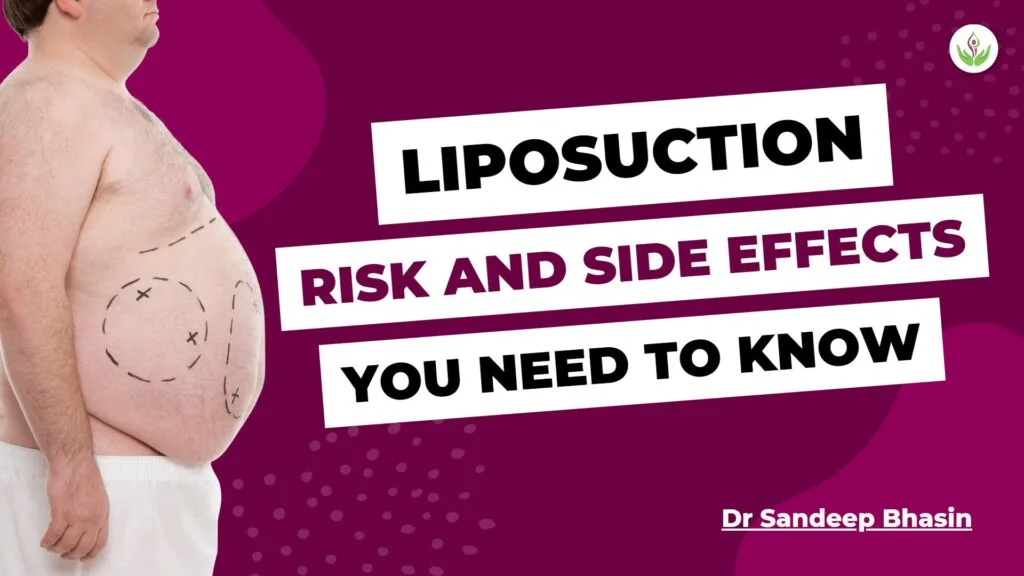 Liposuction: Risk and Side Effects That You Need To Know