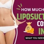 Liposuction Cost In India: What You Need To Know