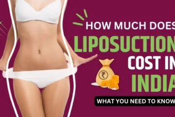 Liposuction Cost In India: What You Need To Know