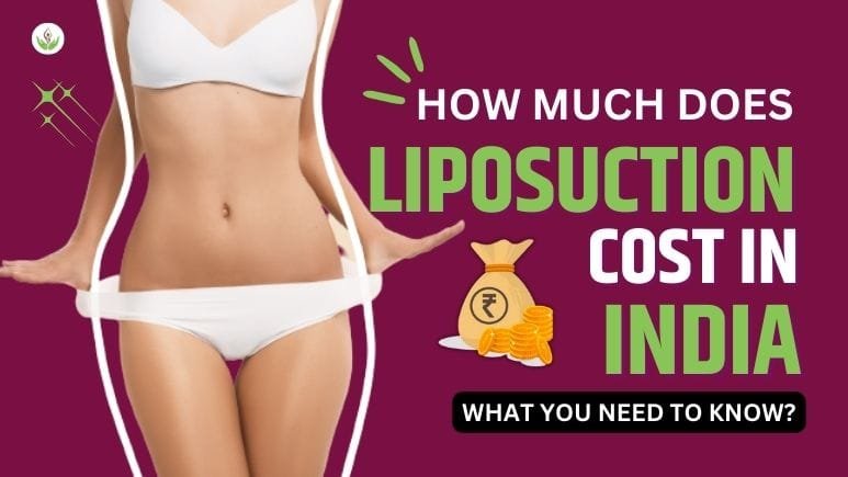 Liposuction Cost In India: What You Need To Know