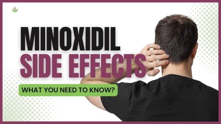 Minoxidil Side Effects: What You Need to Know