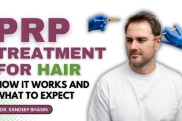 PRP Treatment for Hair: How It Works and What to Expect