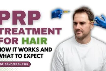 PRP Treatment for Hair: How It Works and What to Expect