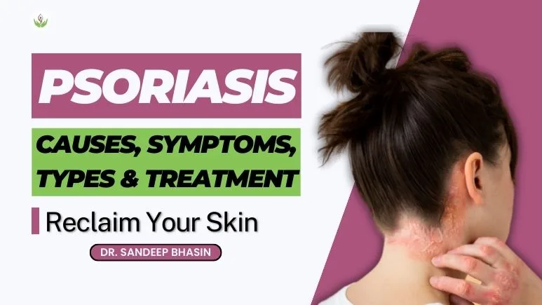 Psoriasis Unveiled: Causes, Types, Symptoms and Solutions
