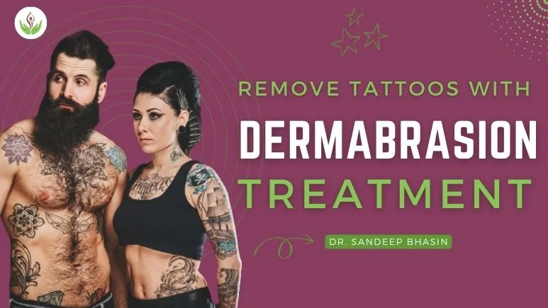 Dermabrasion Treatment for Tattoo Removal