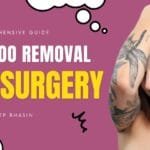 Tattoo Removal by Surgery: A Comprehensive Guide