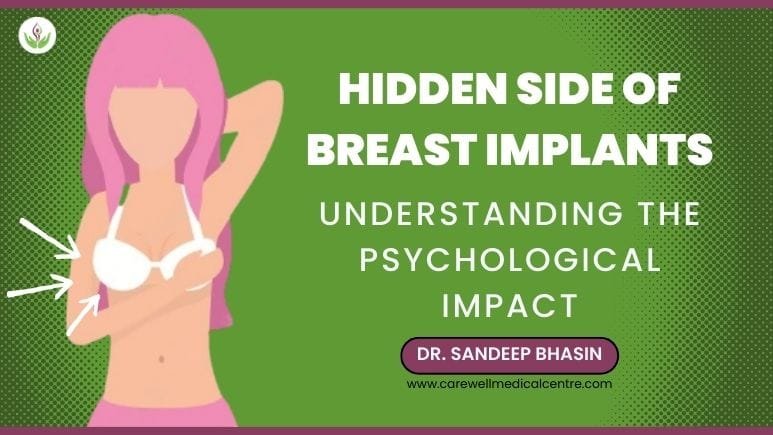 The Hidden Side of Breast Implants: Understanding the Psychological Impact
