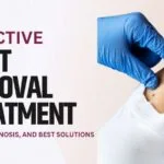 Effective Wart Removal Treatments: Causes, Diagnosis