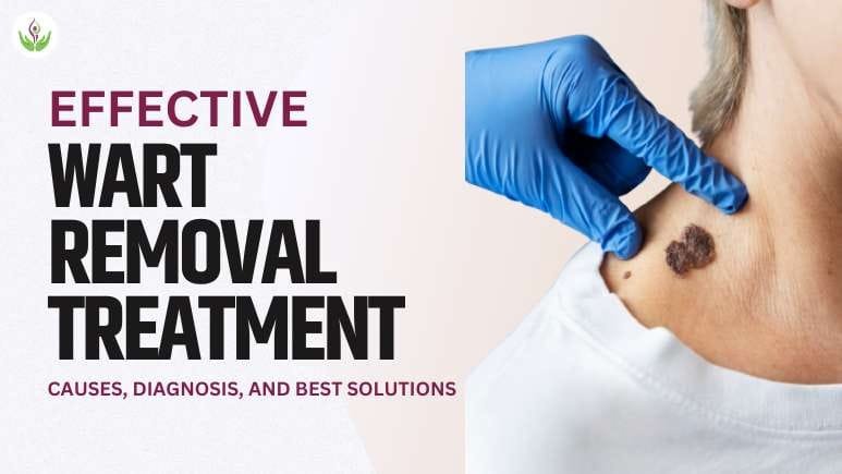 Effective Wart Removal Treatments: Causes, Diagnosis