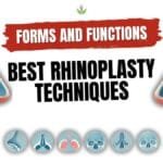What are the Best Rhinoplasty Techniques? Its forms and functions?