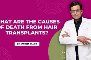 What are the Causes of Death from Hair Transplants?