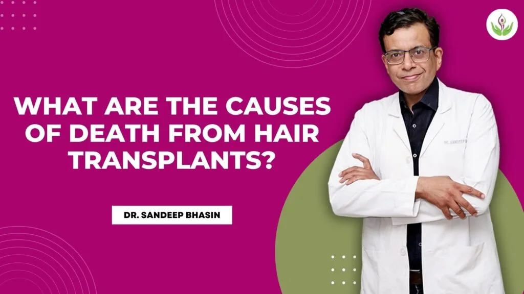What are the Causes of Death from Hair Transplants?