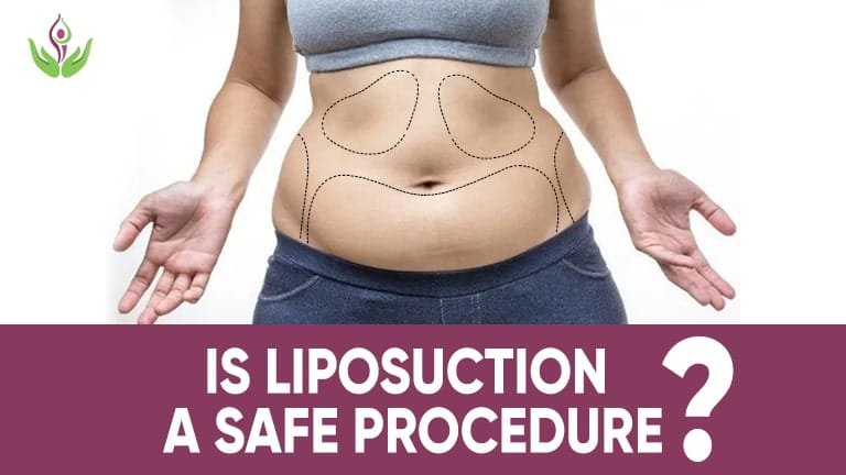 Is Liposuction A Safe Procedure?