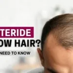 Can Finasteride Regrow Hair? All You Need to Know