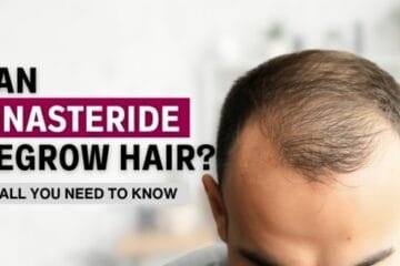 Can Finasteride Regrow Hair? All You Need to Know