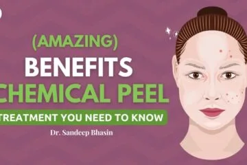 Amazing Benefits Of A Chemical Peel – Treatment You Need To Know