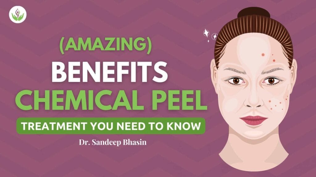 Amazing Benefits Of A Chemical Peel – Treatment You Need To Know