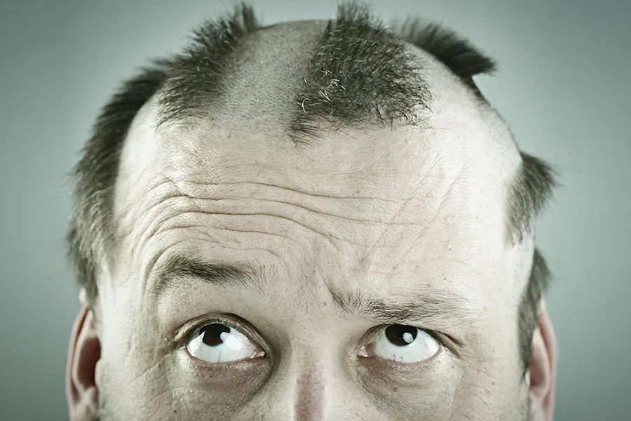 A Complete Guide About Hair Weaving