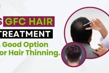 Is GFC Hair Treatment a Good Option for Hair Thinning