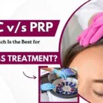 GFC v/s PRP Which Is the Best for Hair Loss Treatment