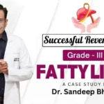 grade-3-fatty-liver-reversal-case-study
