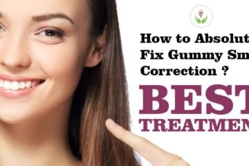 How to Absolutely Fix Gummy Smile Correction? Know Best Treatment