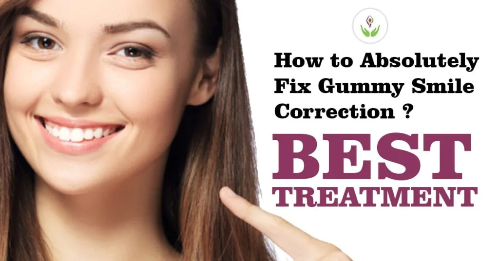 How to Absolutely Fix Gummy Smile Correction? Know Best Treatment