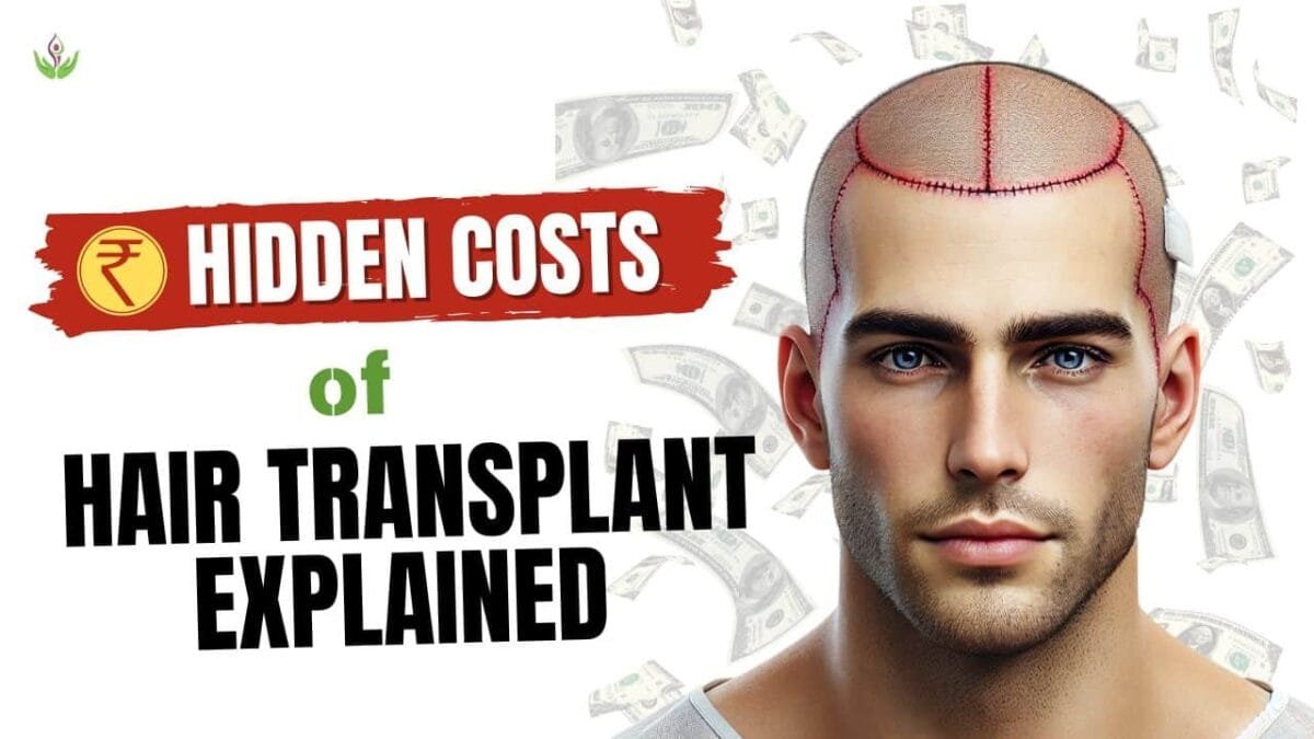 What Are the Hidden Costs of Hair Transplants