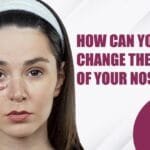 How Can You Change the Shape of Your Nose
