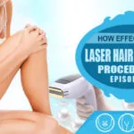 How Effective is Laser Hair Removal Procedure?