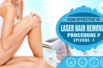 How Effective is Laser Hair Removal Procedure?