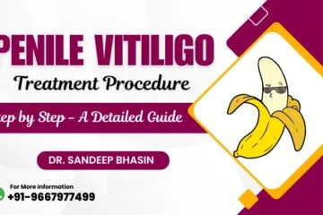 Penile Vitiligo Treatment Procedure Step by Step – A Detailed Guide