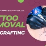 Skin Grafting For Tattoo Removal