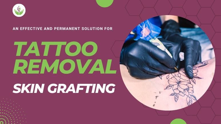 Skin Grafting For Tattoo Removal