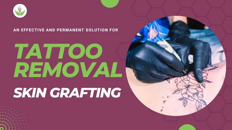 Skin Grafting For Tattoo Removal