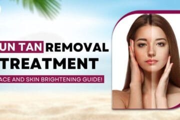 Sun Tan Removal Treatment: A Face and Skin Brightening Guide