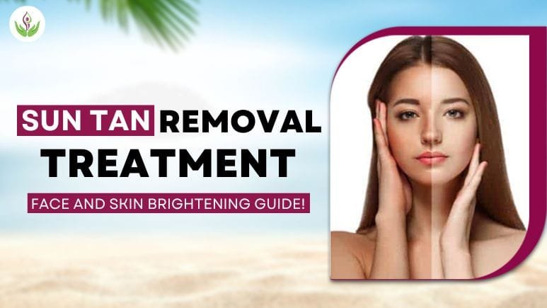 Sun Tan Removal Treatment: A Face and Skin Brightening Guide